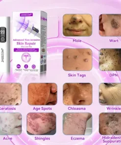 Advanced Non-Invasive Skin Repair CO₂ Laser Pen