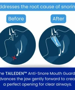 Anti-Snore Mouth Guard+