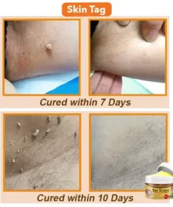 Bee Venom Comprehensive Cream