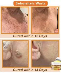 Bee Venom Comprehensive Cream