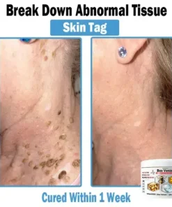 Bee Venom Multi-Symptom Skin Treatment Cream