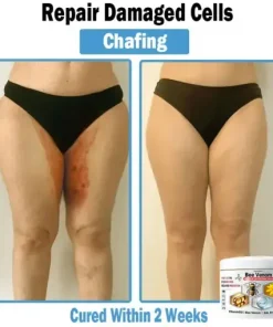 Bee Venom Multi-Symptom Skin Treatment Cream