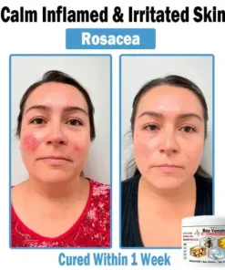 Bee Venom Multi-Symptom Skin Treatment Cream