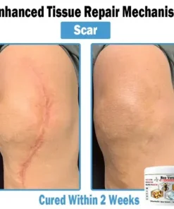 Bee Venom Multi-Symptom Skin Treatment Cream