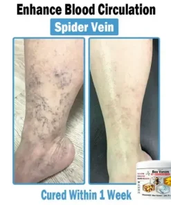 Bee Venom Multi-Symptom Skin Treatment Cream