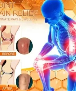 Bee-Venom Pain-Relief Bone Healing Cream