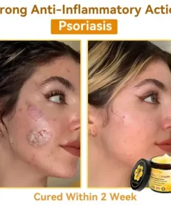 Bee Venom Repair Cream