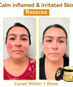 Bee Venom Repair Cream