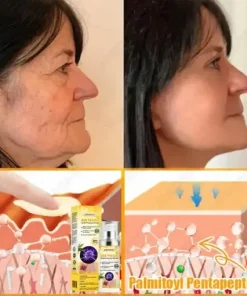 Bee Venom Senile Purpura Cream