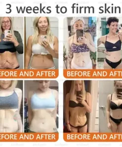 Bee Venom Skin Cream