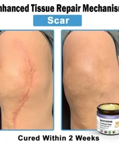 Bee Venom Skin Treatment Cream