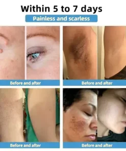 Bee Venom Skin Treatment Cream