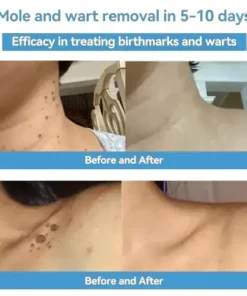 Bee Venom Skin Treatment Cream