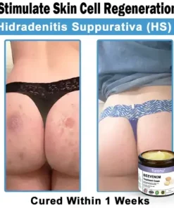 Bee Venom Skin Treatment Cream