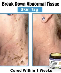 Bee Venom Skin Treatment Cream