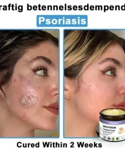 Bee Venom Skin Treatment Cream