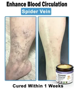 Bee Venom Skin Treatment Cream