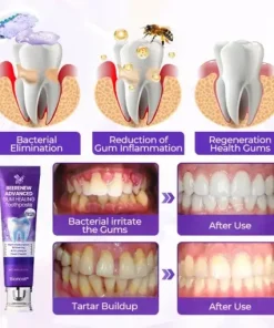 BeeRenew Advanced Gum Healing Toothpaste