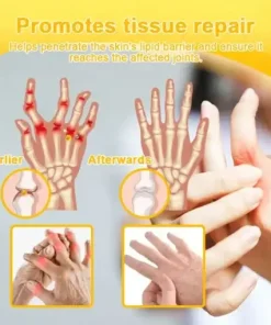 Botulinum Toxin & Bee Venom Pain-Relief Bone Healing Cream