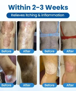 Cougex® PCA Magnesium Deep Repair Spray