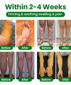 Cougex® VenoLift Leg Relief Spray