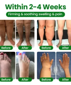 Cougex® VenoLift Leg Relief Spray