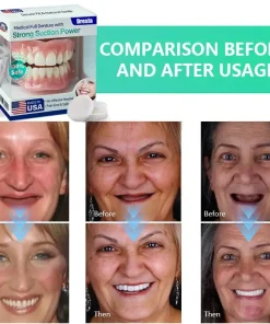 Dresfa® Medical Full Denture with Strong Suction