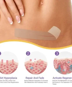 Hyaluronic Acid Nano Microneedle Repair Tape