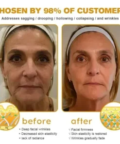 Instant skin tightening Cream