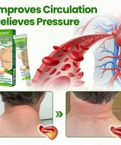 KnotAway Lipoma Removal Cream