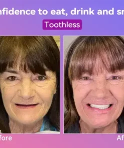Latest Premium Comfort Dentures