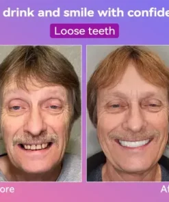 Latest Premium Comfort Dentures