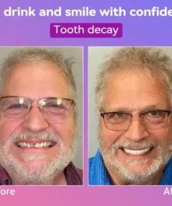 Latest Premium Comfort Dentures