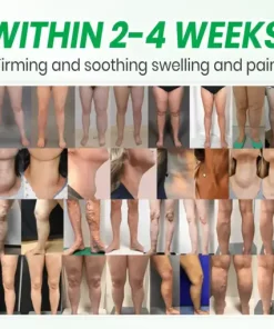 Lymphatic Detox Herbal Cream