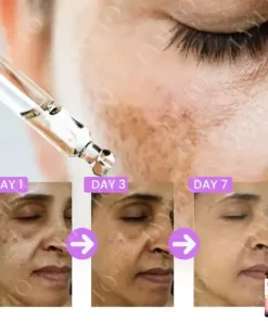 MelantraX Advanced Brightening Essence ACE