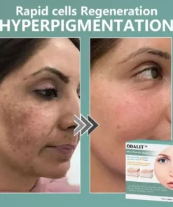 MicroNeedle Botanic skin Tag Removal Patch