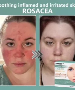 MicroNeedle Botanic skin Tag Removal Patch