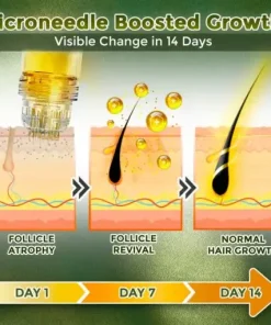 Microneedle Herbal Infusion Hair Stimulation Set