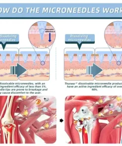 Nano-microneedle joint patch