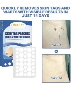 Natural Skin Tag and Wart Removal Patches
