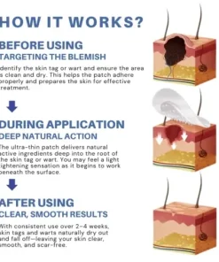 Natural Skin Tag and Wart Removal Patches