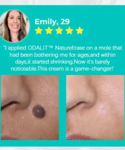 Nature Erase Instant Mole & Spot Removal Gel