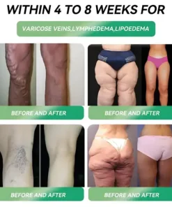 Oral Weight Loss Solution Indications