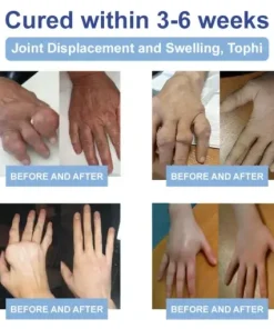 Ourlyard® Magnesium Pain Healing Bone Cream