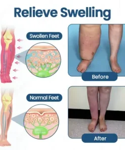 Roll-On Pump Cream for Lymphatic Drainage & Swelling Relief