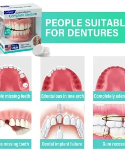 Suction-fit Complete Denture