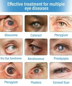 Supramolecular Eye Drops