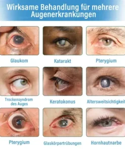 Supramolekulare Augentropfen