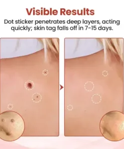 TagDrop Painless Micro Patch