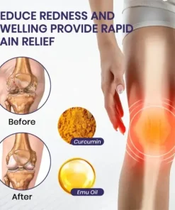 Turmeric & Emu Oil Arthritis Soothing Pain Relief Massage Gel